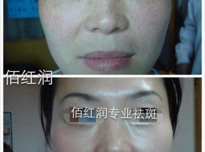 前后對(duì)比照