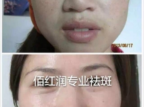 前后對(duì)比照